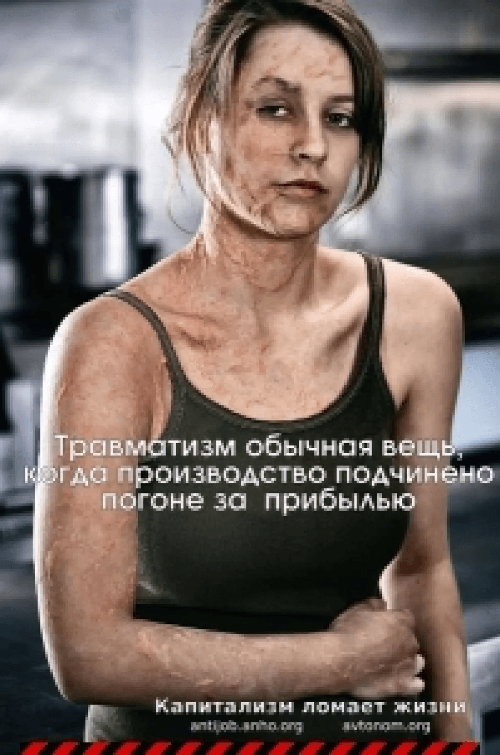 Производственный травматизм